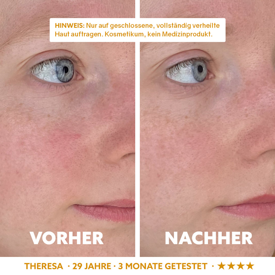 Neuro-Sensitive Skin Serum 'Dermasoothe'