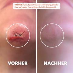 Huile cicatrisante bio « Pure Repair »