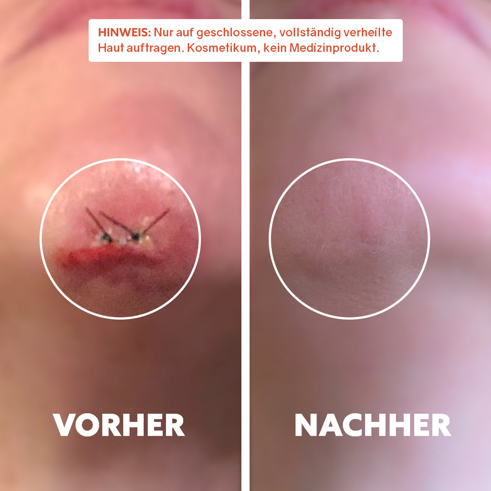 Huile cicatrisante bio « Pure Repair »