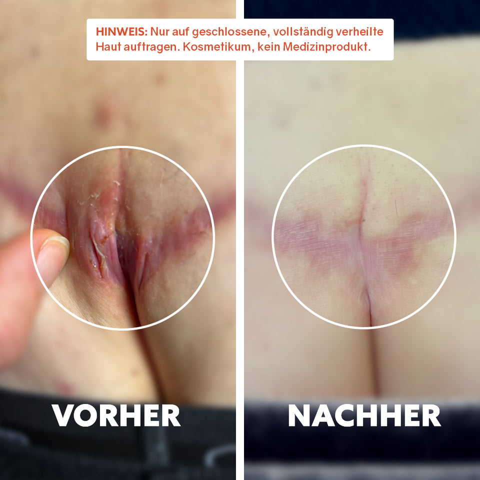 Huile cicatrisante bio « Pure Repair »