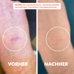 Huile cicatrisante bio « Pure Repair »