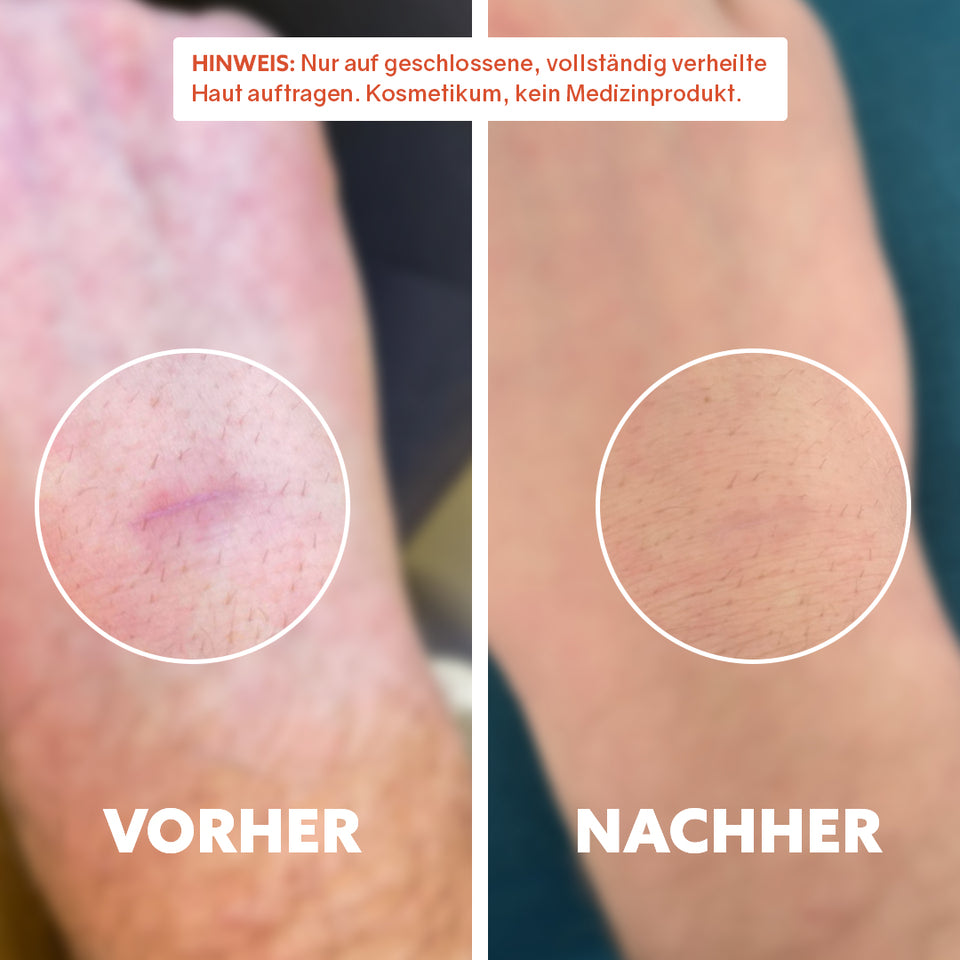 Huile cicatrisante bio « Pure Repair »