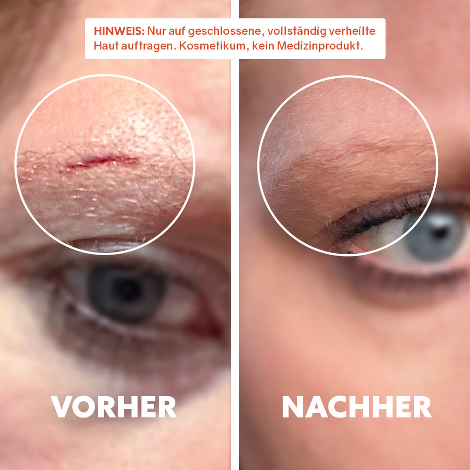 Huile cicatrisante bio « Pure Repair »