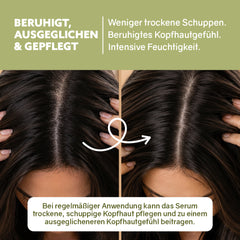 Kopfhautserum ‘Verschiedene Sorten‘