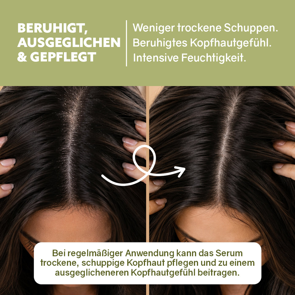 Kopfhautserum ‘Anti-Schuppen‘