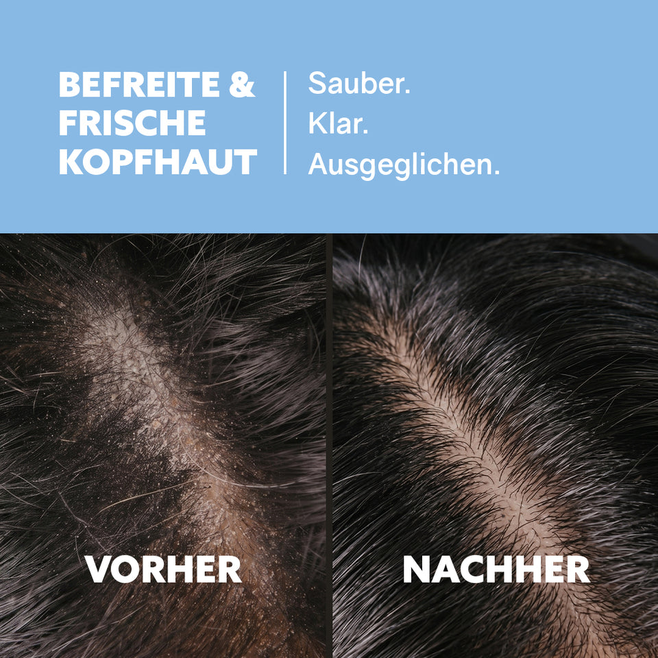 Hair care set 'Volumeboost'
